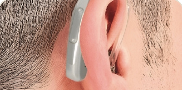 Aparelho auditivo retroauricular na orelha