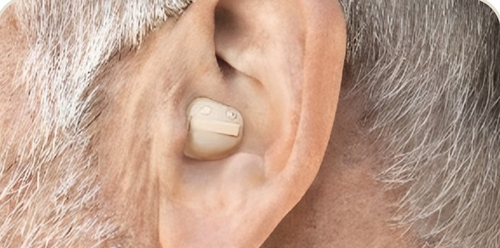 Aparelho auditivo intracanal na orelha